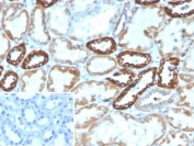 IHC staining of FFPE human kidney tissue with PLA2R1 antibody (clone PLA2R1/4891). Inset: PBS used in place of primary Ab (secondary Ab negative control). HIER: boil tissue sections in pH 9 10mM Tris with 1mM EDTA for 20 min and allow to cool before testing.