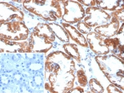 IHC staining of FFPE human kidney tissue with Phospholipase A2 Receptor 1 antibody (clone PLA2R1/4898). Inset: PBS used in place of primary Ab (secondary Ab negative control). HIER: boil tissue sections in pH 9 10mM Tris with 1mM EDTA for 20 min and allow to cool before testing.
