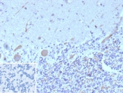 IHC staining of FFPE human brain tissue with FLT3 antibody (clone FLT3/9884). Inset: PBS used in place of primary Ab (secondary Ab negative control). HIER: boil tissue sections in pH 9 10mM Tris with 1mM EDTA for 20 min and allow to cool before testing.
