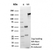 SDS-PAGE analysis of purified, BSA-free Fms-like tyrosine kinase 3 antibody (clone FLT3/9887) as confirmation of integrity and purity.