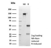 SDS-PAGE analysis of purified, BSA-free CD135 antibody (clone FLT3/9888) as confirmation of integrity and purity.