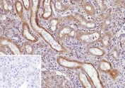 IHC staining of FFPE human kidney tissue with CD135 antibody (clone FLT3/9888). Inset: PBS used in place of primary Ab (secondary Ab negative control). HIER: boil tissue sections in pH 9 10mM Tris with 1mM EDTA for 20 min and allow to cool before testing.
