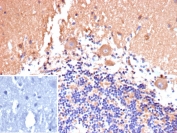 IHC staining of FFPE human brain tissue with CD135 antibody (clone FLT3/9889). Inset: PBS used in place of primary Ab (secondary Ab negative control). HIER: boil tissue sections in pH 9 10mM Tris with 1mM EDTA for 20 min and allow to cool before testing.