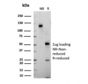 SDS-PAGE analysis of purified, BSA-free recombinant Gastrin antibody (clone GAST/8646R) as confirmation of integrity and purity.