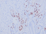 IHC staining of FFPE human gastric antrum tissue with recombinant Gastrin antibody (clone GAST/8646R). Inset: PBS used in place of primary Ab (secondary Ab negative control). HIER: boil tissue sections in pH 9 10mM Tris with 1mM EDTA for 20 min and allow to cool before testing.