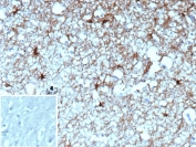 IHC staining of FFPE human brain tissue with GFAP antibody (clone GFAP/9420). Inset: PBS used in place of primary Ab (secondary Ab negative control). HIER: boil tissue sections in pH 9 10mM Tris with 1mM EDTA for 20 min and allow to cool before testing.