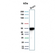 Western blot testing of human brain tissue with Glial fibrillary acidic protein antibody (clone GFAP/9425). Predicted molecular weight ~50 kDa.