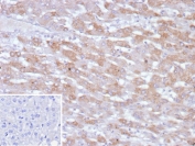 IHC staining of FFPE human hepatocellular carcinoma tissue with PHPT1 antibody (clone PHPT1/12053). Inset: PBS used in place of primary Ab (secondary Ab negative control). HIER: boil tissue sections in pH 9 10mM Tris with 1mM EDTA for 20 min and allow to cool before testing.