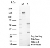SDS-PAGE analysis of purified, BSA-free Hexokinase 1 antibody (clone HK1/9515) as confirmation of integrity and purity.