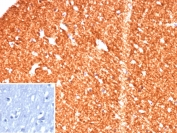 IHC staining of FFPE human brain tissue with Hexokinase 1 antibody (clone HK1/9515). Inset: PBS used in place of primary Ab (secondary Ab negative control). HIER: boil tissue sections in pH 9 10mM Tris with 1mM EDTA for 20 min and allow to cool before testing.
