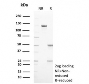 SDS-PAGE analysis of purified, BSA-free Hexokinase 1 antibody (clone HK1/9517) as confirmation of integrity and purity.