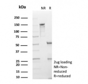 SDS-PAGE analysis of purified, BSA-free HK1 antibody (clone HK1/9506) as confirmation of integrity and purity.