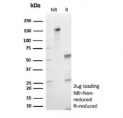 SDS-PAGE analysis of purified, BSA-free HK1 antibody (clone HK1/9509) as confirmation of integrity and purity.