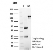 SDS-PAGE analysis of purified, BSA-free Hexokinase 1 antibody (clone HK1/9510) as confirmation of integrity and purity.