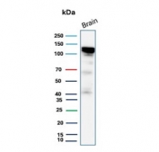 Western blot testing of human brain tissue lysate with Hexokinase 1 antibody (clone HK1/9510). Predicted molecular weight ~120 kDa.
