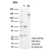 SDS-PAGE analysis of purified, BSA-free HLA-E antibody (clone HLAE/9468) as confirmation of integrity and purity.