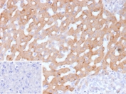 IHC staining of FFPE human hepatocellular carcinoma tissue with HSD17B13 antibody (clone HSD17B13/13101). Inset: PBS used in place of primary Ab (secondary Ab negative control). HIER: boil tissue sections in pH 9 10mM Tris with 1mM EDTA for 20 min and allow to cool before testing.