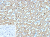 IHC staining of FFPE human hepatocellular carcinoma tissue with HSD17B13 antibody (clone HSD17B13/13110). Inset: PBS used in place of primary Ab (secondary Ab negative control). HIER: boil tissue sections in pH 9 10mM Tris with 1mM EDTA for 20 min and allow to cool before testing.