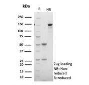 SDS-PAGE analysis of purified, BSA-free HSD17B13 antibody (clone HSD17B13/13102) as confirmation of integrity and purity.