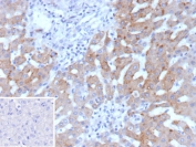 IHC staining of FFPE human hepatocellular carcinoma tissue with HSD17B13 antibody (clone HSD17B13/13102). Inset: PBS used in place of primary Ab (secondary Ab negative control). HIER: boil tissue sections in pH 9 10mM Tris with 1mM EDTA for 20 min and allow to cool before testing.
