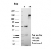 SDS-PAGE analysis of purified, BSA-free 17-beta-HSD 13 antibody (clone HSD17B13/13104) as confirmation of integrity and purity.