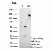SDS-PAGE analysis of purified, BSA-free HSD17B13 antibody (clone HSD17B13/13106) as confirmation of integrity and purity.