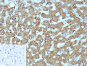 IHC staining of FFPE human hepatocellular carcinoma tissue with HSD17B13 antibody (clone HSD17B13/13106). Inset: PBS used in place of primary Ab (secondary Ab negative control). HIER: boil tissue sections in pH 9 10mM Tris with 1mM EDTA for 20 min and allow to cool before testing.