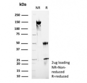 SDS-PAGE analysis of purified, BSA-free Hydroxysteroid 17-beta dehydrogenase 13 antibody (clone HSD17B13/13108) as confirmation of integrity and purity.