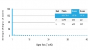 Analysis of HuProt(TM) microarray containing more than 19,000 full-length human proteins using Hydroxysteroid 17-beta dehydrogenase 13 antibody (clone HSD17B13/13108). These results demonstrate the foremost specificity of the HSD17B13/13108 mAb. Z- and S- score: The Z-score represents the strength of a signal that an antibody (in combination with a fluorescently-tagged anti-IgG secondary Ab) produces when binding to a particular protein on the HuProt(TM) array. Z-scores are described in units of standard deviations (SD's) above the mean value of all signals generated on that array. If the targets on the HuProt(TM) are arranged in descending order of the Z-score, the S-score is the difference (also in units of SD's) between the Z-scores. The S-score therefore represents the relative target specificity of an Ab to its intended target.