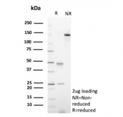 SDS-PAGE analysis of purified, BSA-free recombinant Amyloid beta antibody (clone APP/9971R) as confirmation of integrity and purity.