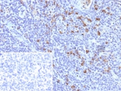 IHC staining of FFPE human tonsil tissue with IGLV1-51 antibody (clone IGLC1/9475). Inset: PBS used in place of primary Ab (secondary Ab negative control). HIER: boil tissue sections in pH 9 10mM Tris with 1mM EDTA for 20 min and allow to cool before testing.