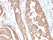 IHC staining of FFPE human small intestine tissue with Aquaporin 4 antibody (clone AQP4/3321). Inset: PBS used in place of primary Ab (secondary Ab negative control). HIER: boil tissue sections in pH 9 10mM Tris with 1mM EDTA for 20 min and allow to cool before testing.