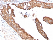IHC staining of FFPE human small intestine tissue with AQP4 antibody (clone AQP4/3322). Inset: PBS used in place of primary Ab (secondary Ab negative control). HIER: boil tissue sections in pH 9 10mM Tris with 1mM EDTA for 20 min and allow to cool before testing.