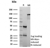 SDS-PAGE analysis of purified, BSA-free Inhibin alpha chain antibody (clone INHA/9354) as confirmation of integrity and purity.