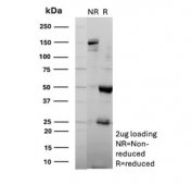 SDS-PAGE analysis of purified, BSA-free Arginase 1 antibody (clone ARG1/9446) as confirmation of integrity and purity.
