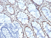 IHC staining of FFPE human colon tissue with HES5 antibody (clone HES5/8035). Inset: PBS used in place of primary Ab (secondary Ab negative control). HIER: boil tissue sections in pH 9 10mM Tris with 1mM EDTA for 20 min and allow to cool before testing.