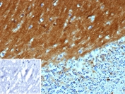 IHC staining of FFPE human brain tissue with Neural cell adhesion molecule L1 antibody (clone L1CAM/13053R). Inset: PBS used in place of primary Ab (secondary Ab negative control). HIER: boil tissue sections in pH 9 10mM Tris with 1mM EDTA for 20 min and allow to cool before testing.
