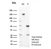 SDS-PAGE analysis of purified, BSA-free Neural cell adhesion molecule L1 antibody (clone L1CAM/13053R) as confirmation of integrity and purity.