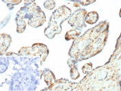 IHC staining of FFPE human placental tissue with Galectin 3 antibody (clone LGALS3/7145). Inset: PBS used in place of primary Ab (secondary Ab negative control). HIER: boil tissue sections in pH 9 10mM Tris with 1mM EDTA for 20 min and allow to cool before testing.