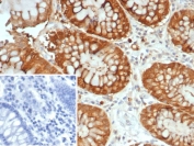 IHC staining of FFPE human colon tissue with Galectin 3 antibody (clone LGALS3/7145). Inset: PBS used in place of primary Ab (secondary Ab negative control). HIER: boil tissue sections in pH 9 10mM Tris with 1mM EDTA for 20 min and allow to cool before testing.