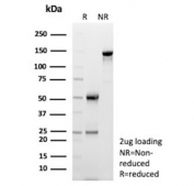 SDS-PAGE analysis of purified, BSA-free Nucleoside diphosphate kinase B antibody (clone NME2/12061) as confirmation of integrity and purity.