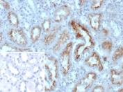 IHC staining of FFPE human kidney tissue with Nucleoside diphosphate kinase B antibody (clone NME2/12061). Inset: PBS used in place of primary Ab (secondary Ab negative control). HIER: boil tissue sections in pH 9 10mM Tris with 1mM EDTA for 20 min and allow to cool before testing.