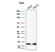 Western blot testing of human 293T and MCF7 cell lysate with NDPK-B antibody (clone NME2/6436). Predicted molecular weight ~17 kDa.