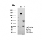 SDS-PAGE analysis of purified, BSA-free NDPK-B antibody (clone NME2/6436) as confirmation of integrity and purity.