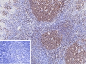 IHC staining of FFPE human tonsil tissue with Paired box 3 antibody (clone PAX3/8424). Inset: PBS used in place of primary Ab (secondary Ab negative control). HIER: boil tissue sections in pH 9 10mM Tris with 1mM EDTA for 20 min and allow to cool before testing.