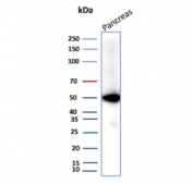 Western blot testing of human pancreas tissue lysate with Pancreatic triacylglycerol lipase antibody (clone PNLIP/9038). Predicted molecular weight ~51 kDa.