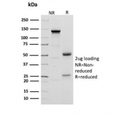 SDS-PAGE analysis of purified, BSA-free Keratin 20 antibody (clone KRT20/3224R) as confirmation of integrity and purity.