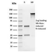 SDS-PAGE analysis of purified, BSA-free recombinant Bax antibody (clone rBAX/962) as confirmation of integrity and purity.