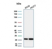 Western blot testing of human A549 and MCF7 cell lysate with recombinant BAX antibody (clone BAX/3158R). Predicted molecular weight ~21 kDa.