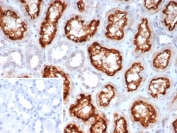 IHC staining of FFPE human kidney tissue with ACE2 antibody (clone ACE2/7202). Inset: PBS used in place of primary Ab (secondary Ab negative control). HIER: boil tissue sections in pH 9 10mM Tris with 1mM EDTA for 20 min and allow to cool before testing.
